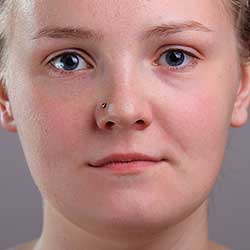 photoshop portrait retouching acne